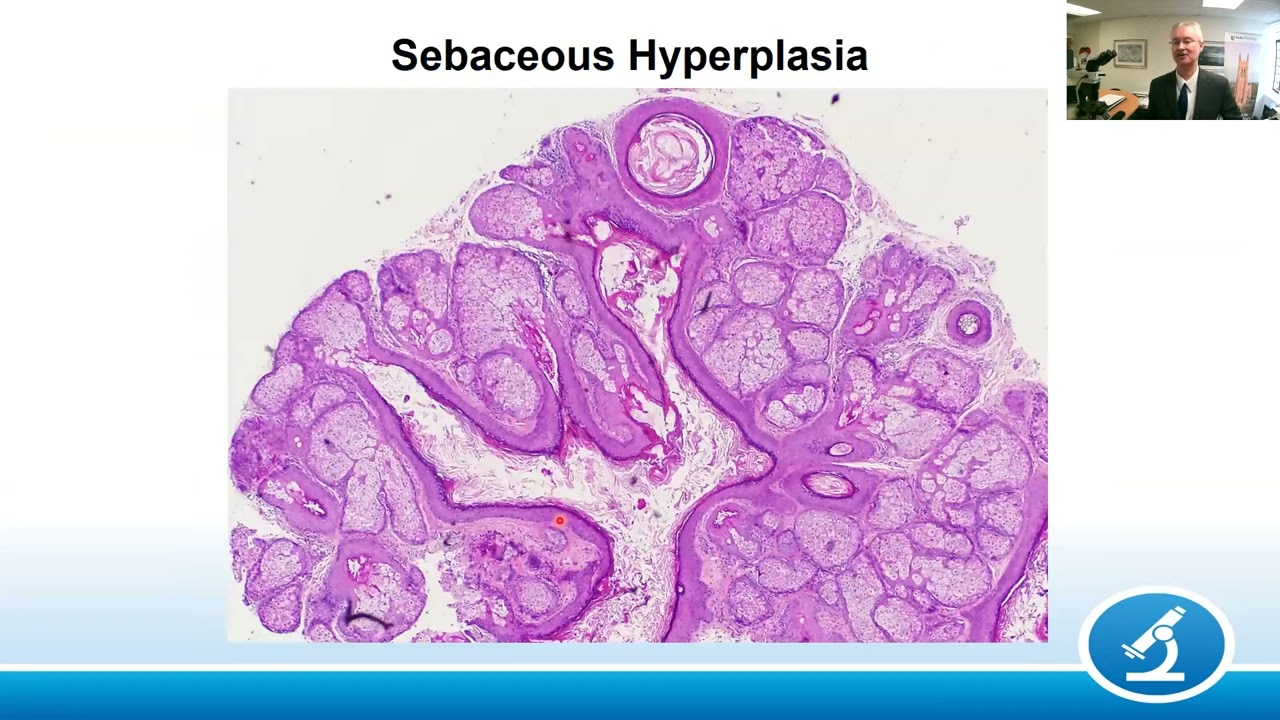 AANP Teaching Rounds - March 27, 2023 - Pathology of the Conjunctiva and Eyelids