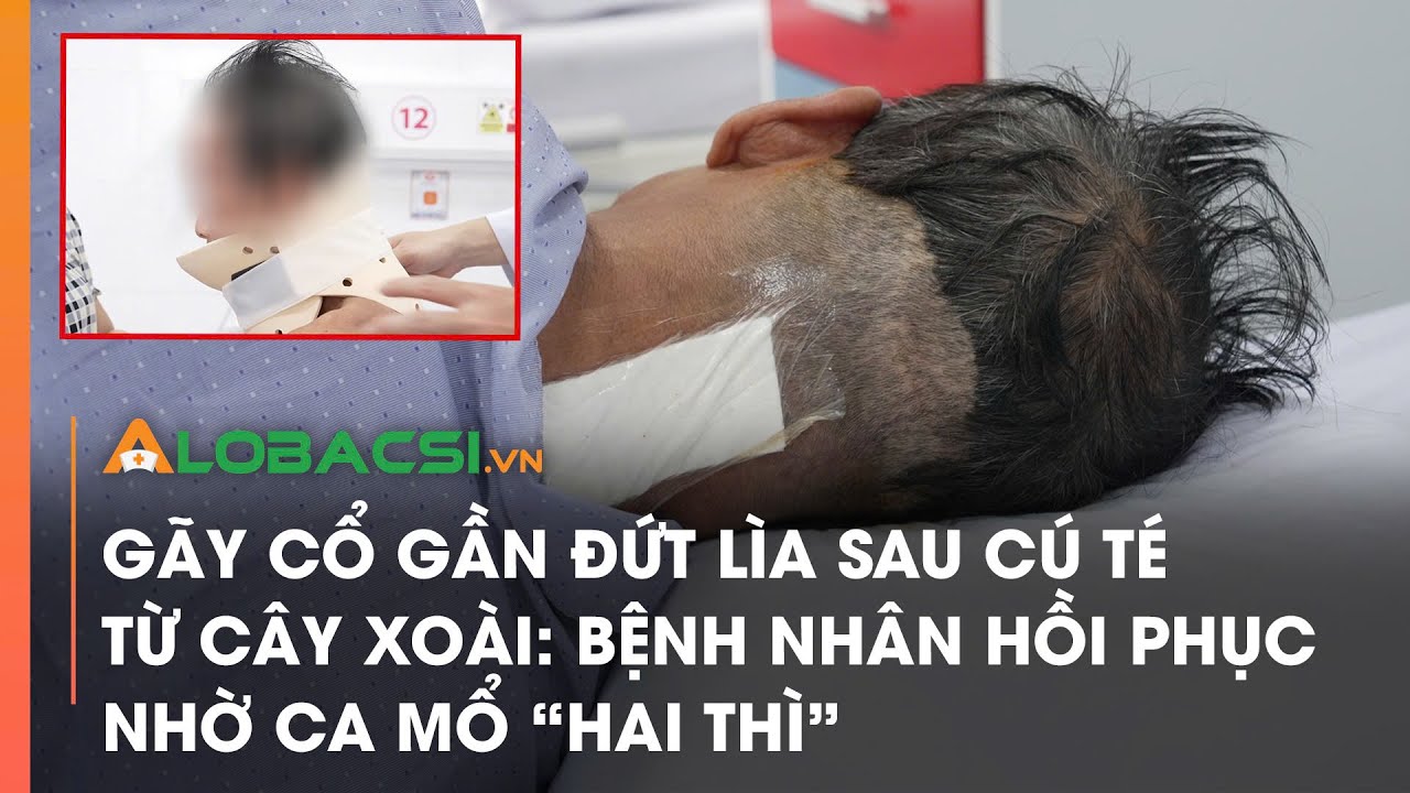 Gãy cổ gần đứt lìa sau cú té từ cây xoài: Bệnh nhân hồi phục nhờ ca mổ 