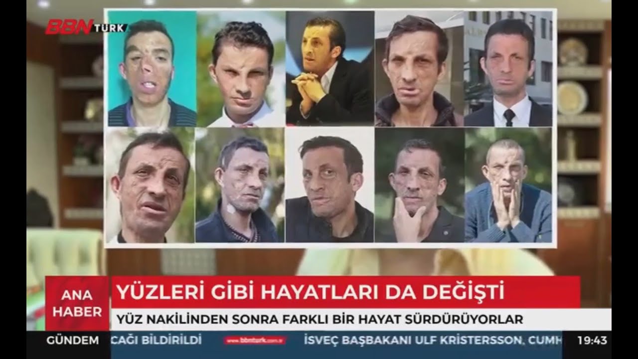 Nakille yüzleri gibi hayatları da değişti