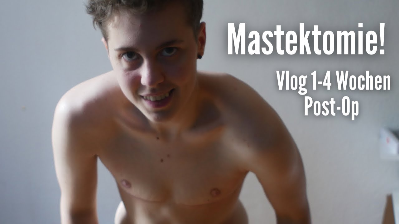 Mastek in Reinbek - Vlog Teil 2: 1-4 Wochen Post-OP (Heilung, Fragen und Pflasterwechsel)