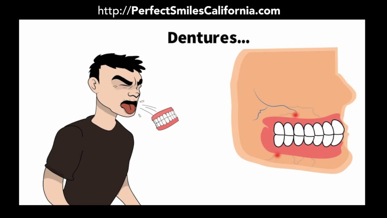 Affordable Implant Dentist in Chula Vista CA