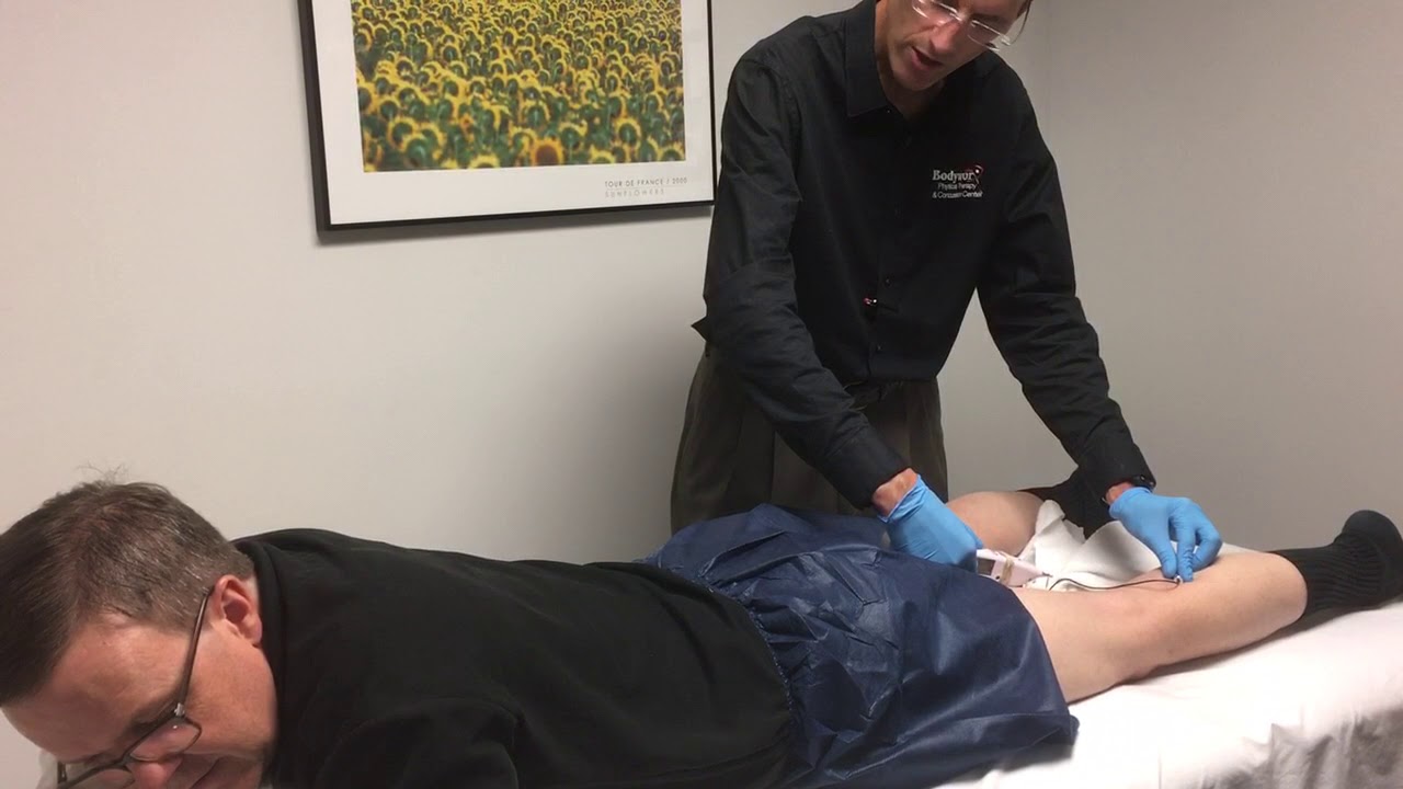 Dry needling in Wichita KS for trigger points and pain