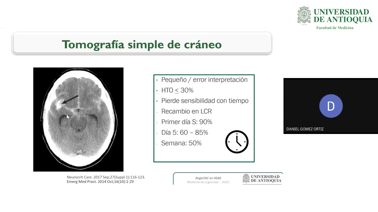 ¿Cuáles son las indicaciones y utilidad del AngioTAC cerebral en HSAE? - Dr. Daniel Gómez