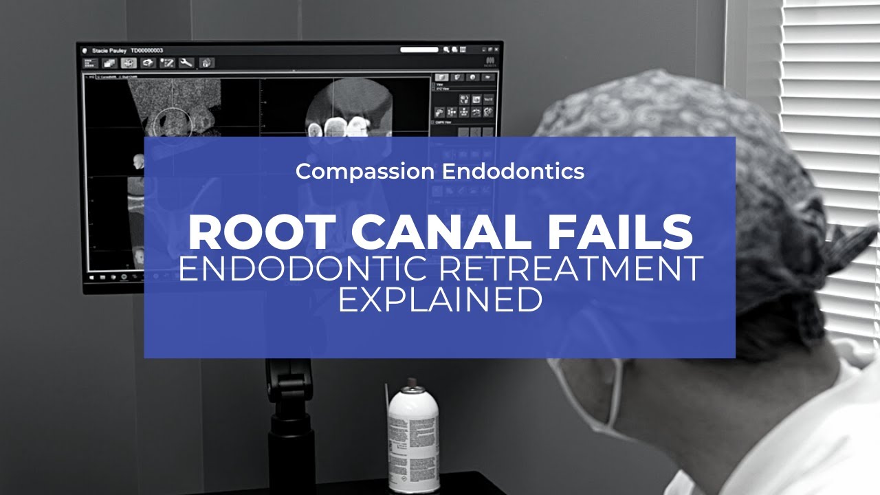 Why do root canals fail?