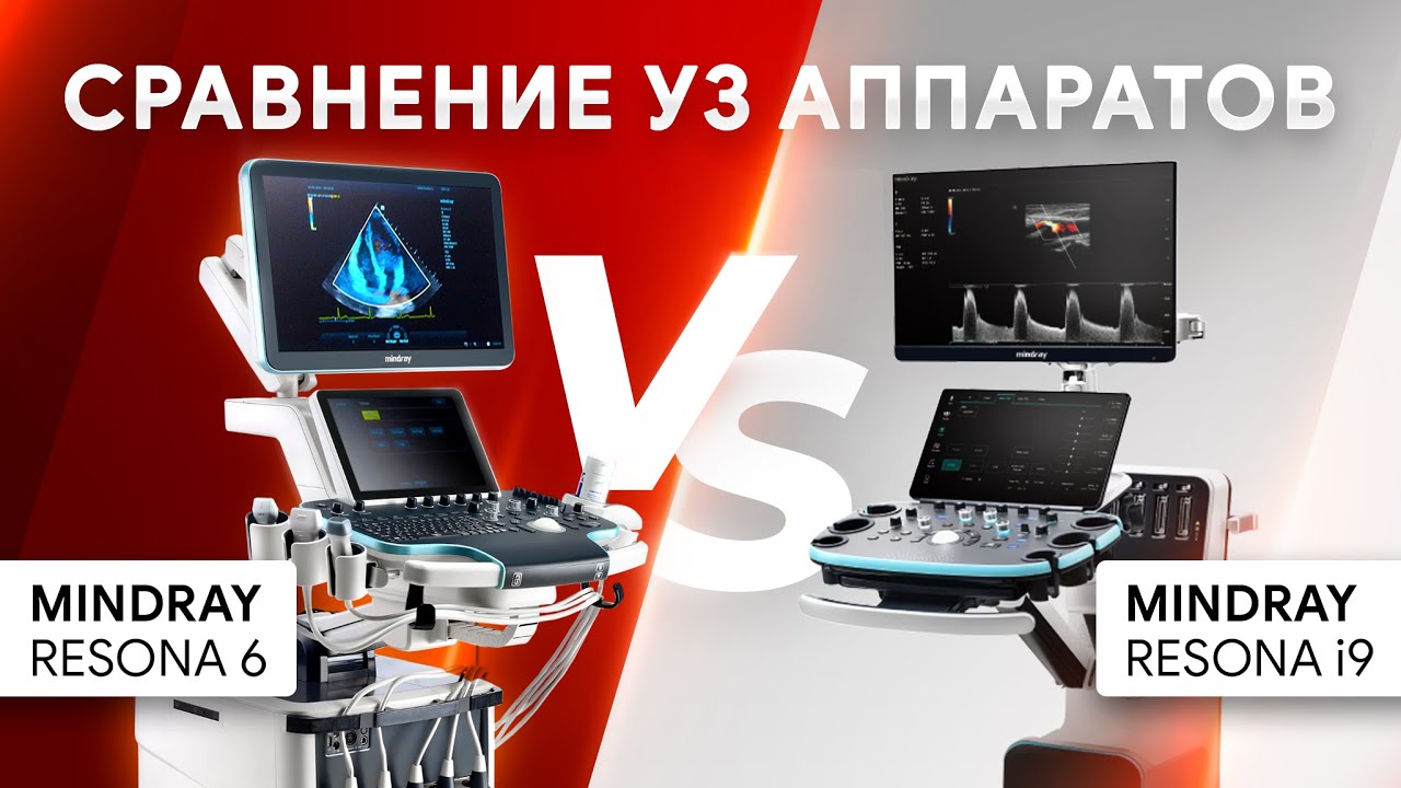 Сравнение УЗИ аппаратов Mindray Resona 6 и Mindray Resona i9