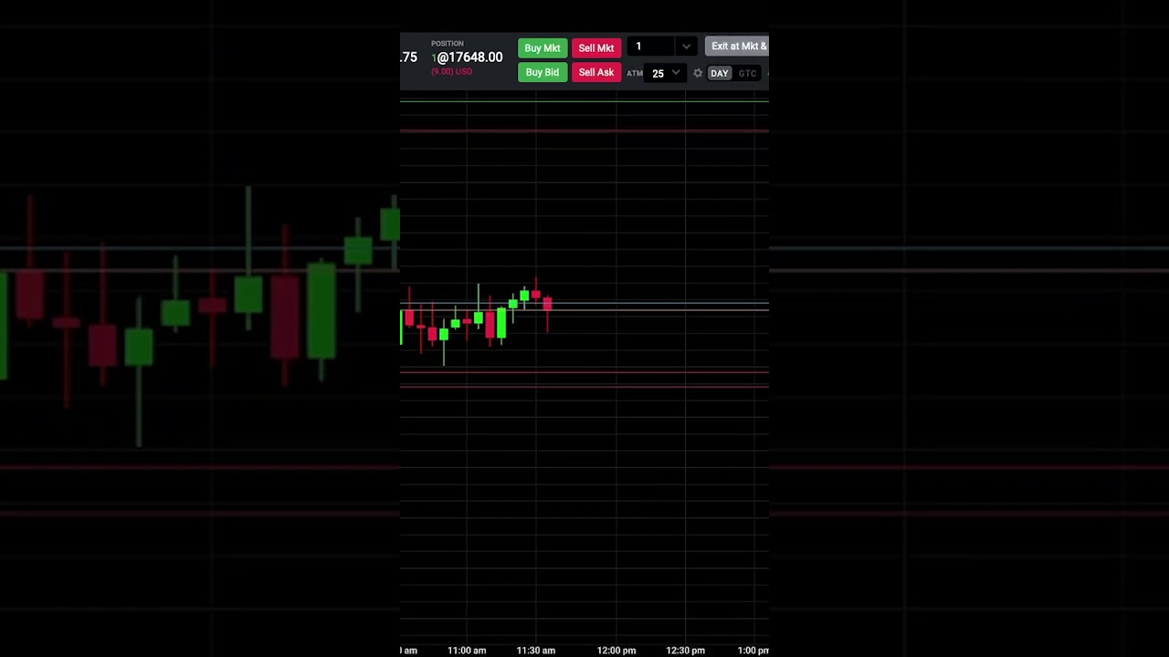 -$197 MNQ Day Trade Trading Futures Strategies #daytraders #tradereview #tradingstrategy #daytrades