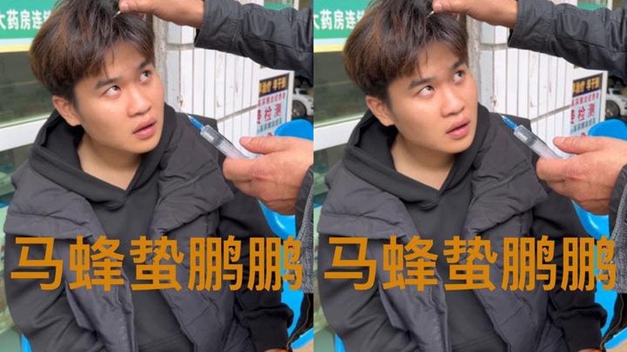 今天鹏鹏上山采菌子，菌子没有采到还被马蜂蛰了一头包…#我的乡村生活 #远嫁的姑娘
