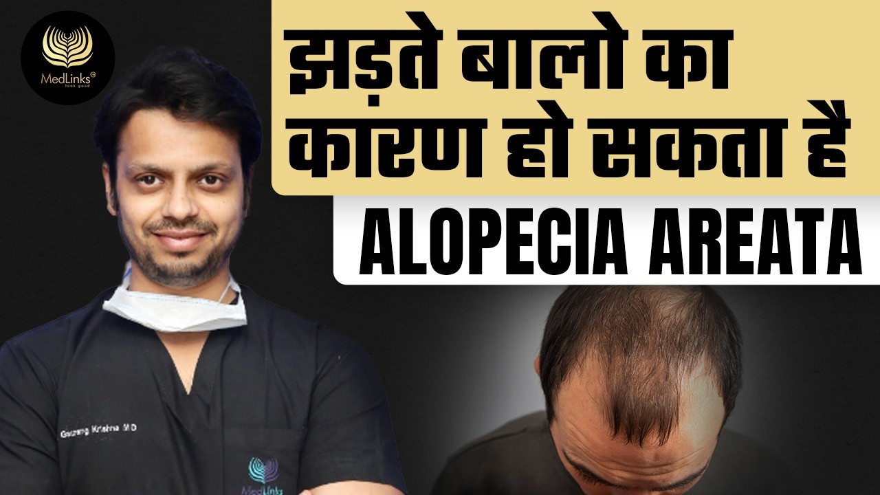 Types of Alopecia Areata & How to Treat It? | Medlinks | Best Hair Transplant in Delhi