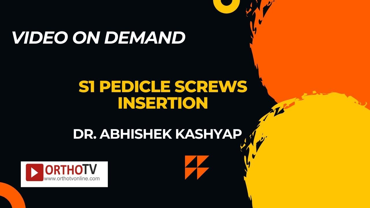 S1 Pedicle Screws Insertion - Dr. Abhishek Kashyap