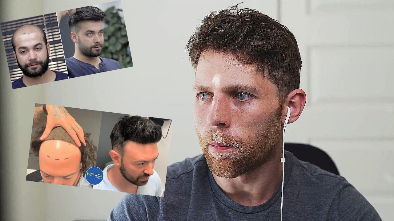 I React to Hair System Transformations From This Past Week!