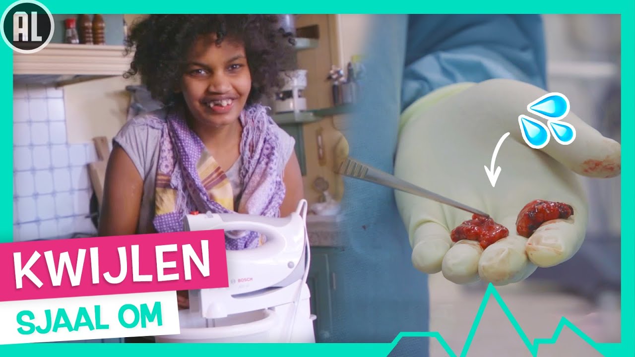 CARMEN KAN NIET GOED SLIKKEN🏥 – TOPDOKS NET FF ANDERS