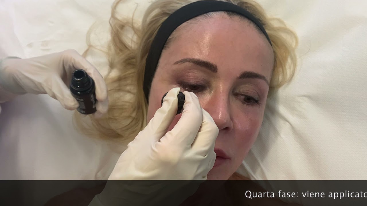 Prevenire l'invecchiamento e massimizzare la qualità della pelle con il peeling B-Twin System
