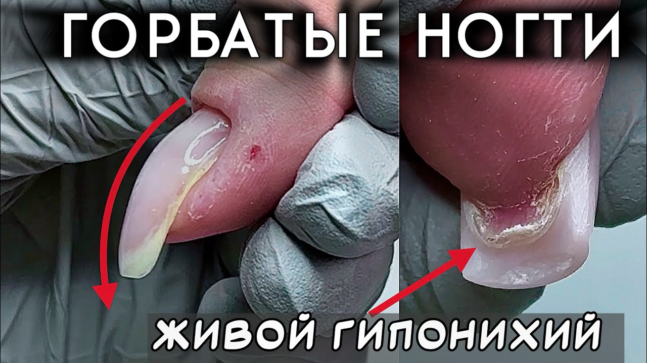 КОВЫРЯЕТ КОЖУ ВОКРУГ НОГТЕЙ  |  НОГТИ КЛЮВЫ #аленалаврентьева #ковыряетногти #грызун #онихофагия