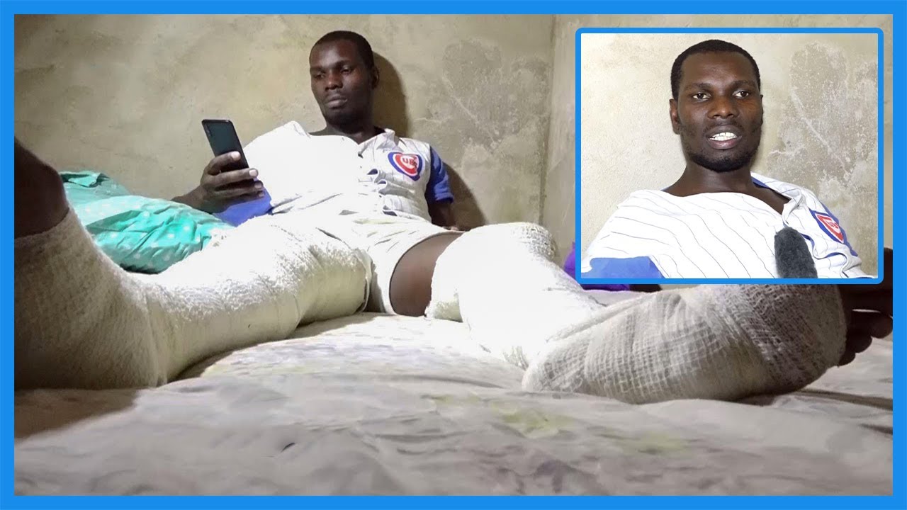 ALIYEVUNJWA MIGUU AKIDAIWA KUCHEPUKA NA MKE WA MKUU WA POLISI ASIMULIA ALIVYOTEKWA!