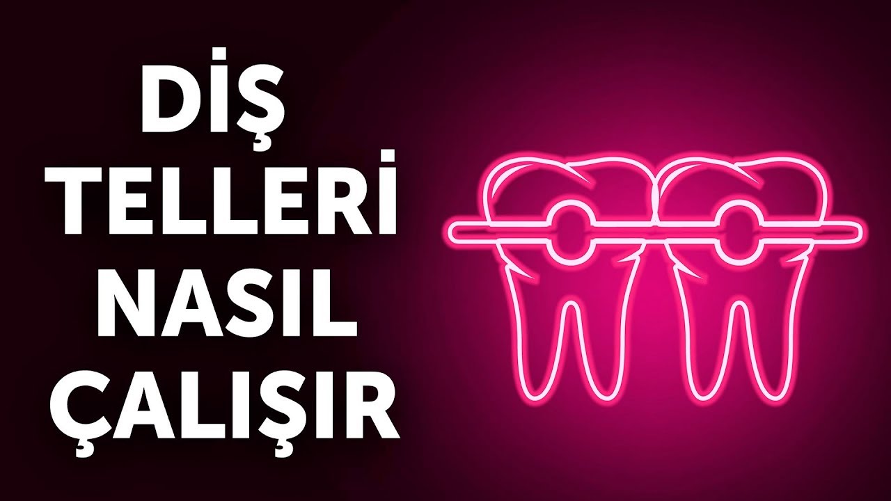 Diş Telleri Nasıl Çalışır (Ve Bu Süreç Neden O Kadar Yavaştır)