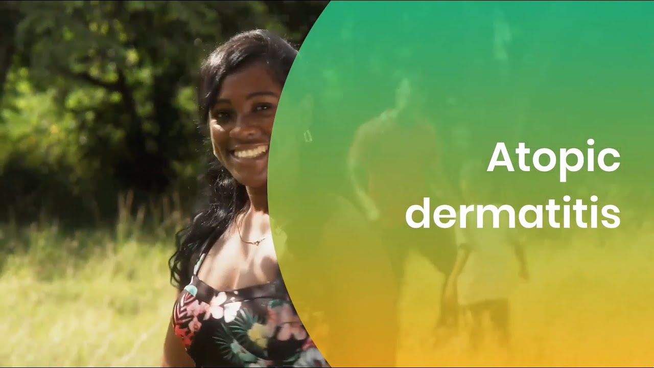 Eczema (Atopic Dermatitis) in Skin of Color: Black Skin, Brown Skin, Dark Skin
