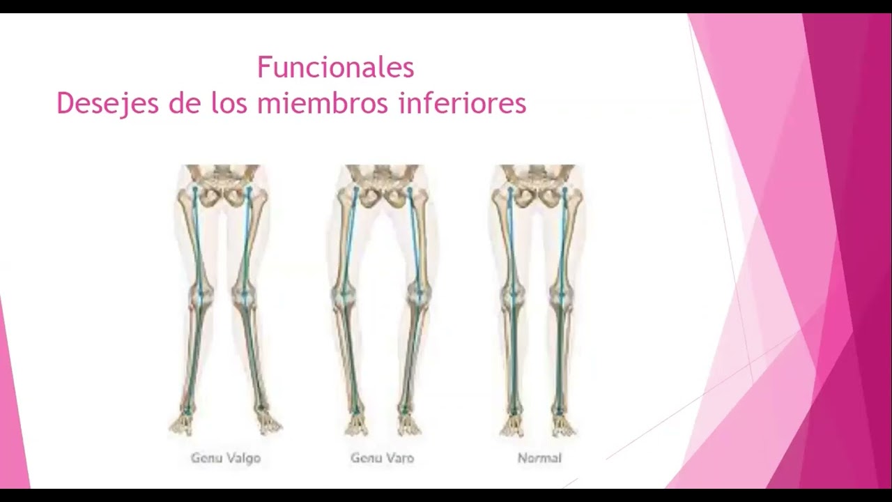 9  Medición de miembros inferiores en Pediatría