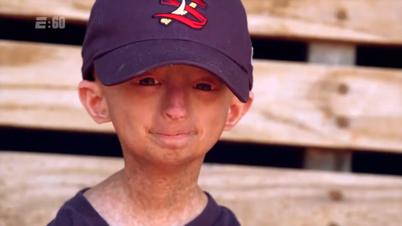 Josiah Viera&rsquo;s love of baseball and love of life continues to inspire | E:60