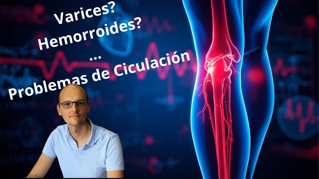 VARICES, HEMORROIDES ….. problemas de circulación? Qué debes saber y cómo mejorarla sencillamente 🙌👣