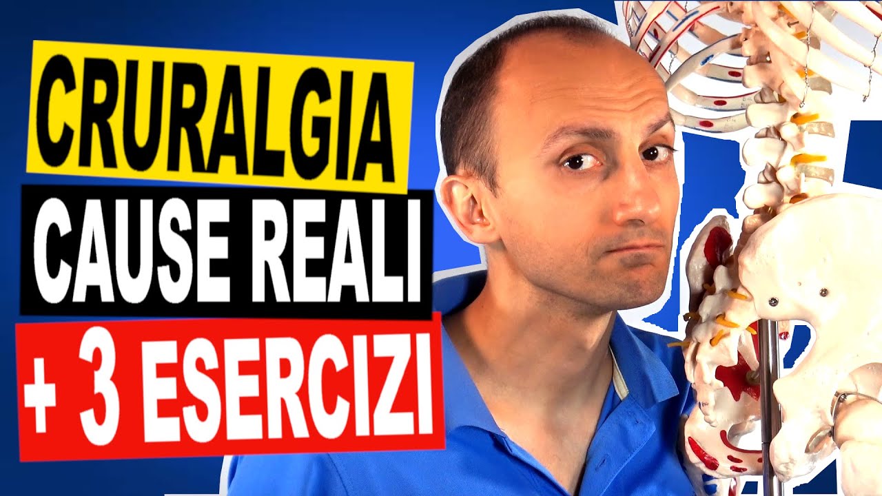 Cruralgia: la Causa e 3 Esercizi di Fisioterapia