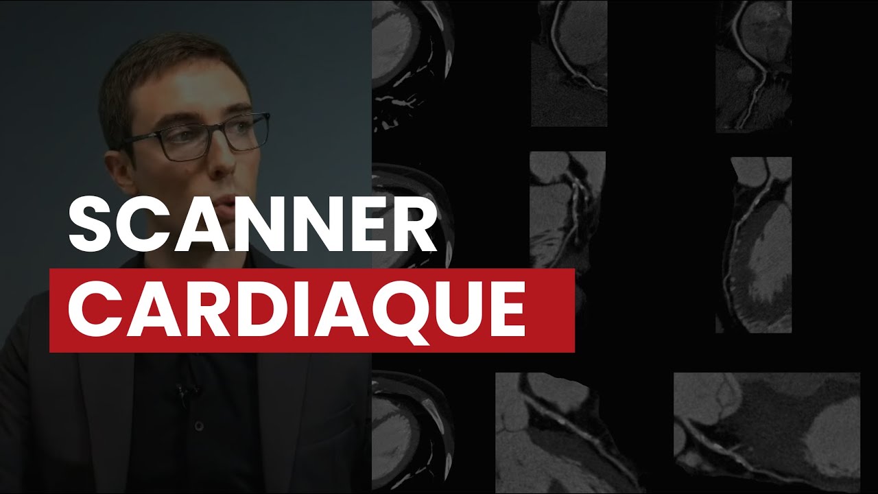 Scanner Cardiaque