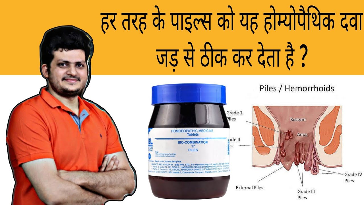 पाइल्स को यह होम्योपैथिक दवा जड़ से ठीक कर देती है | PILES | Bio Combination 17 | How to use |