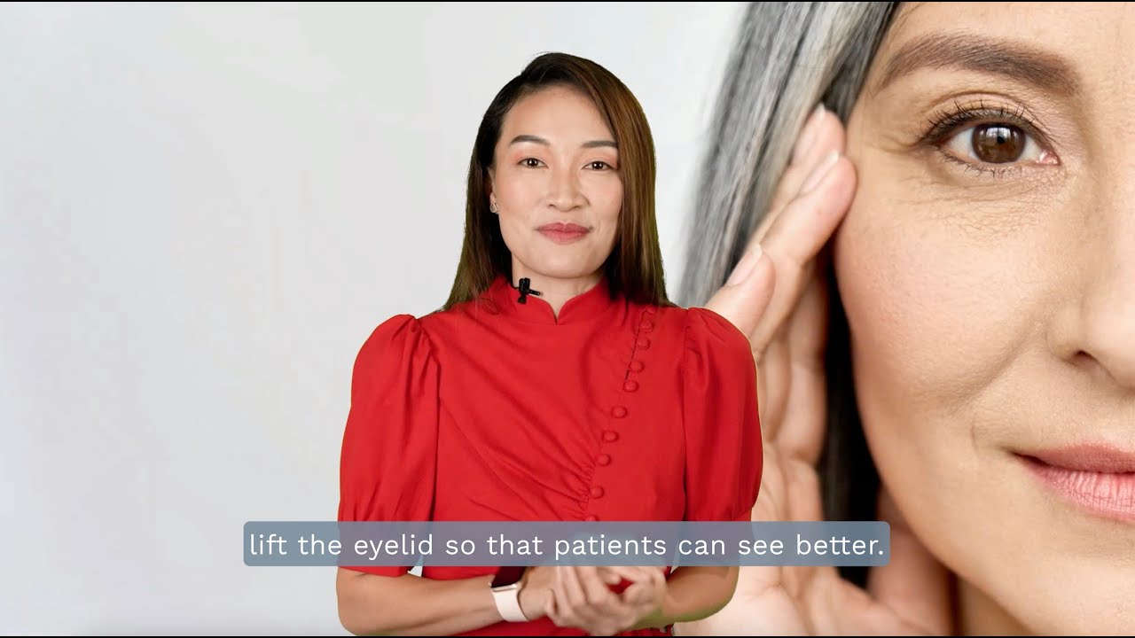 Ptosis Surgery for Droopy Eyelids | Eagle Aesthetics & Surgery