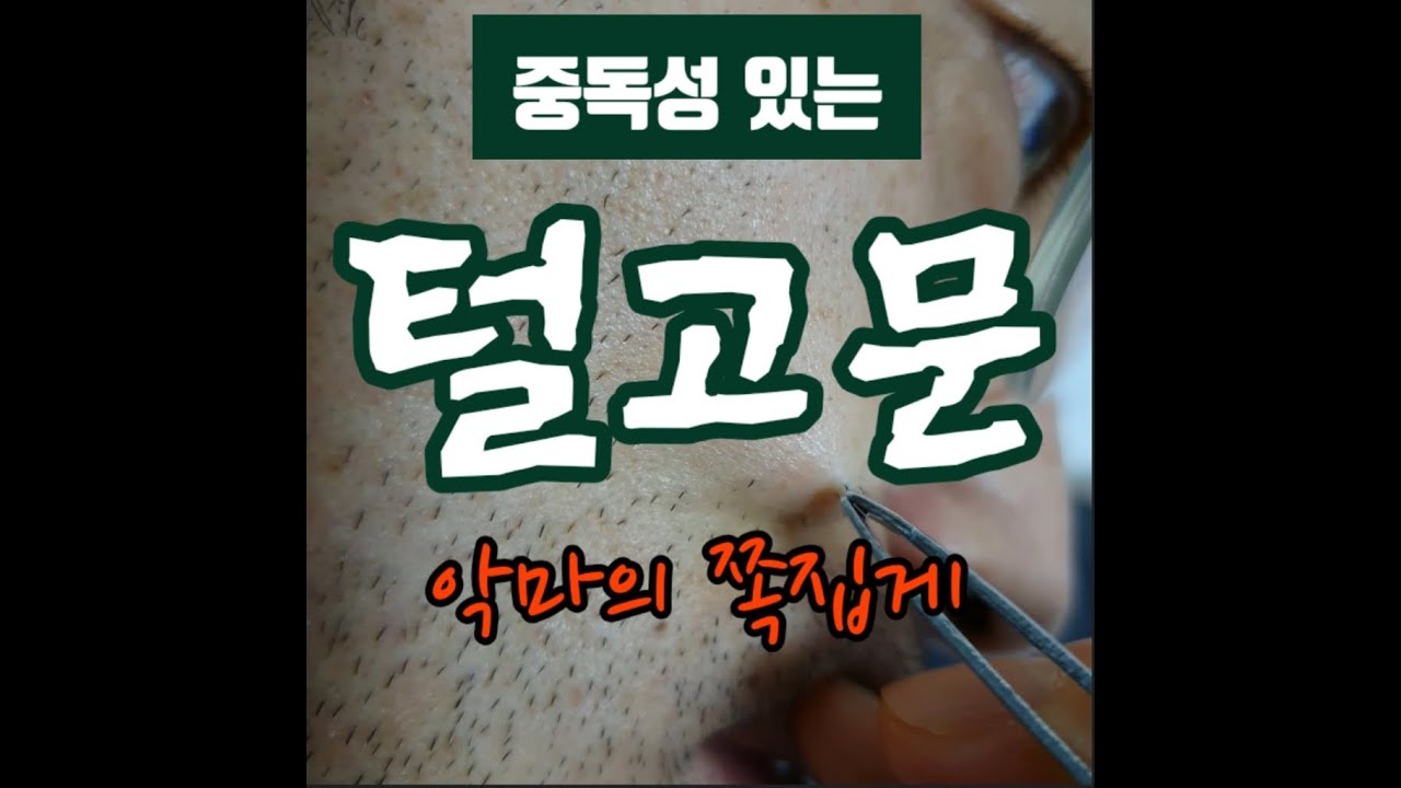 [고통체험] 중독성 있는 샤프심 털뽑기, 턱수염 고문 | 악마의 쪽집게