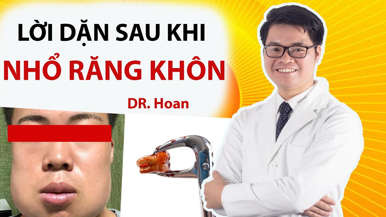 LỜI DẶN SAU KHI NHỔ RĂNG KHÔN ( RĂNG SỐ 8)