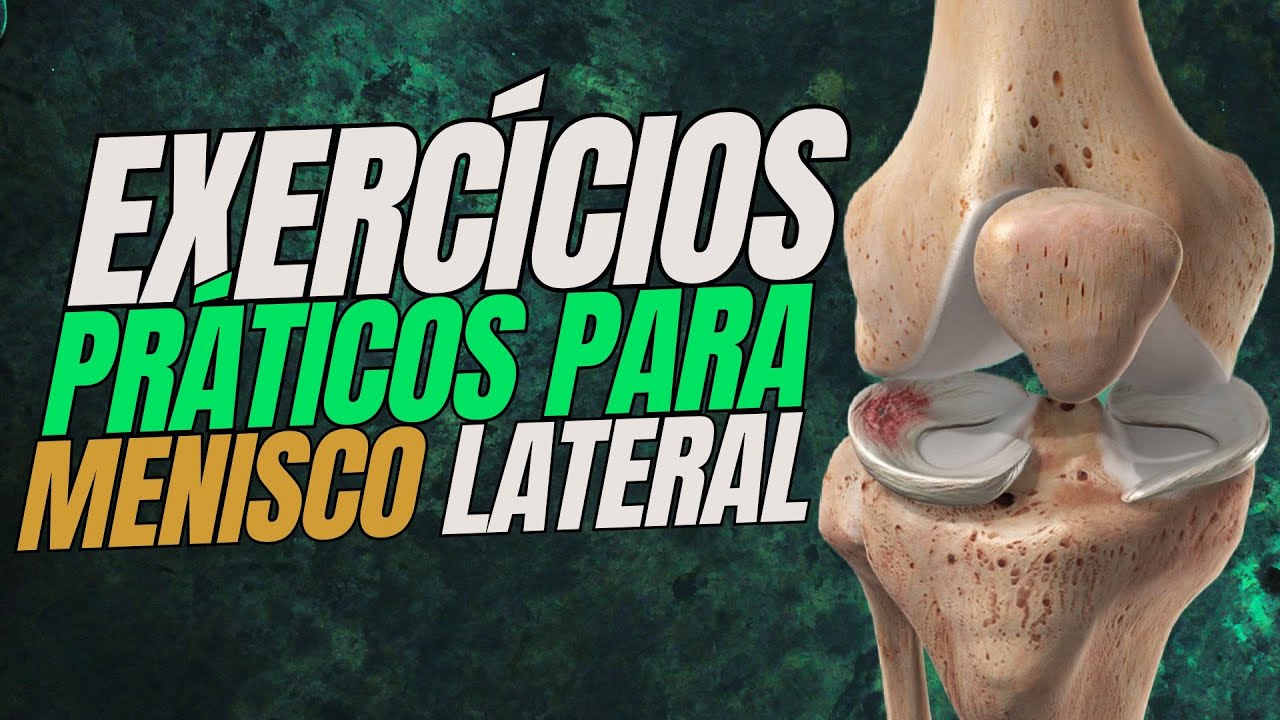Exercícios para Lesão de Menisco Lateral: Acabe com a Dor e a Limitação