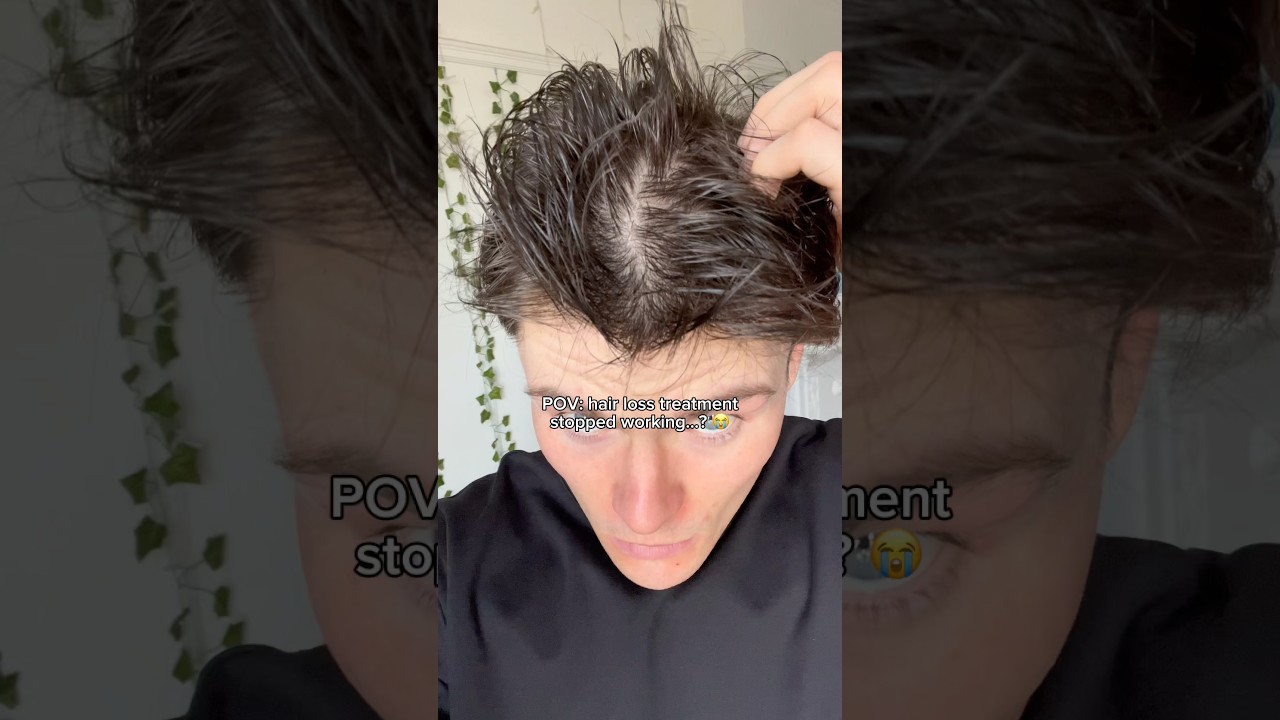 Did finasteride stop working…?