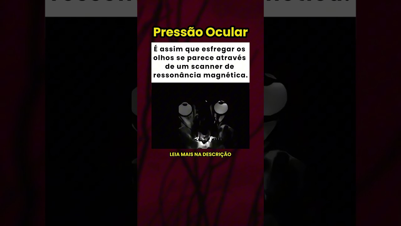 &Eacute; assim que esfregar os olhos se parece em uma resson&acirc;ncia magn&eacute;tica! 👀✋
