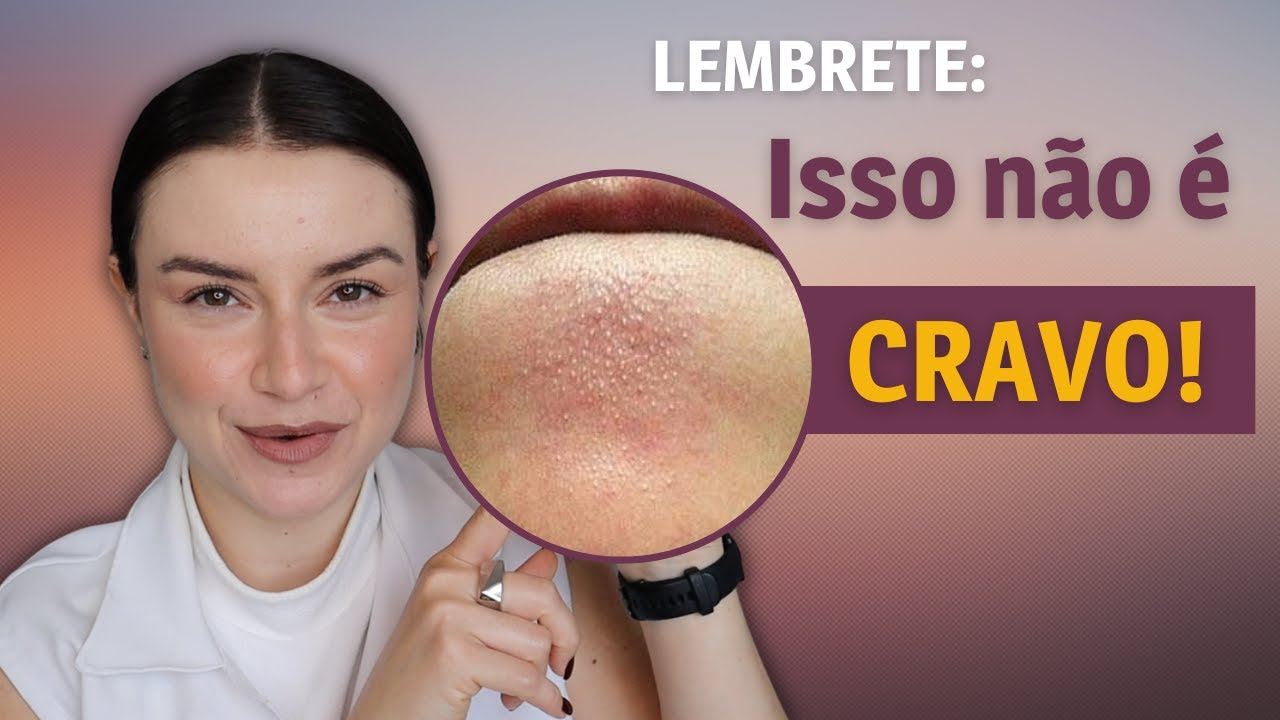 3 dicas de como tirar os cravos | Dica de Esteticista