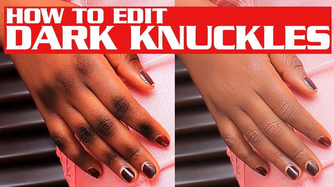 Remove DARK CIRCLES and DARK KNUCKLES in photoshop easily.