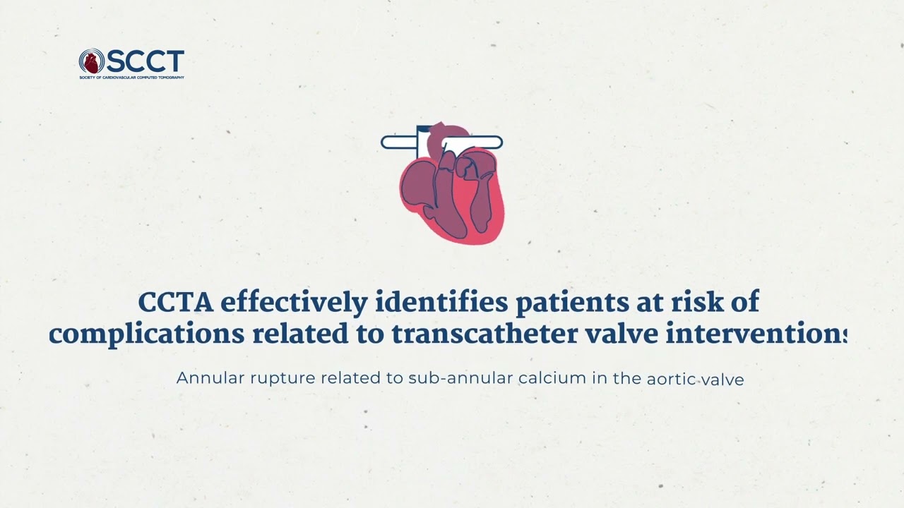 How to use cardiac CT for planning TAVR and TMVR cases: a primer for interventional cardiologists