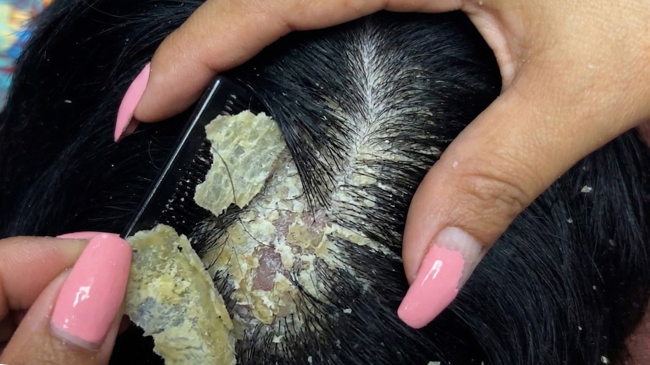 ASMR Deep Scalp Massage & Hair Scratching #DKMO3799