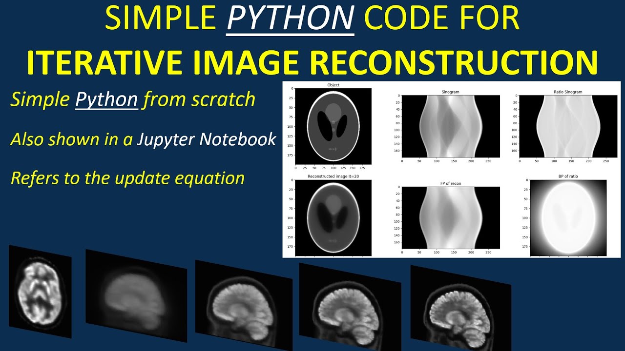 Simple PYTHON code for iterative image reconstruction (also shown for a Jupyter notebook)