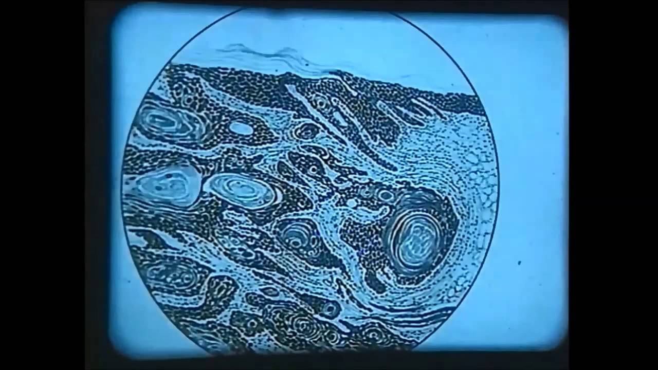 Rebuilding The Middlesex Hospital - fundraising video (1928)