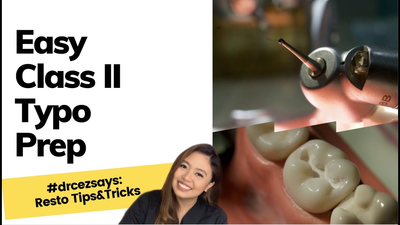 EASY CLASS II TYPO PREPARATION | Resto Tips&Tricks | Dental School | Dr. Cez