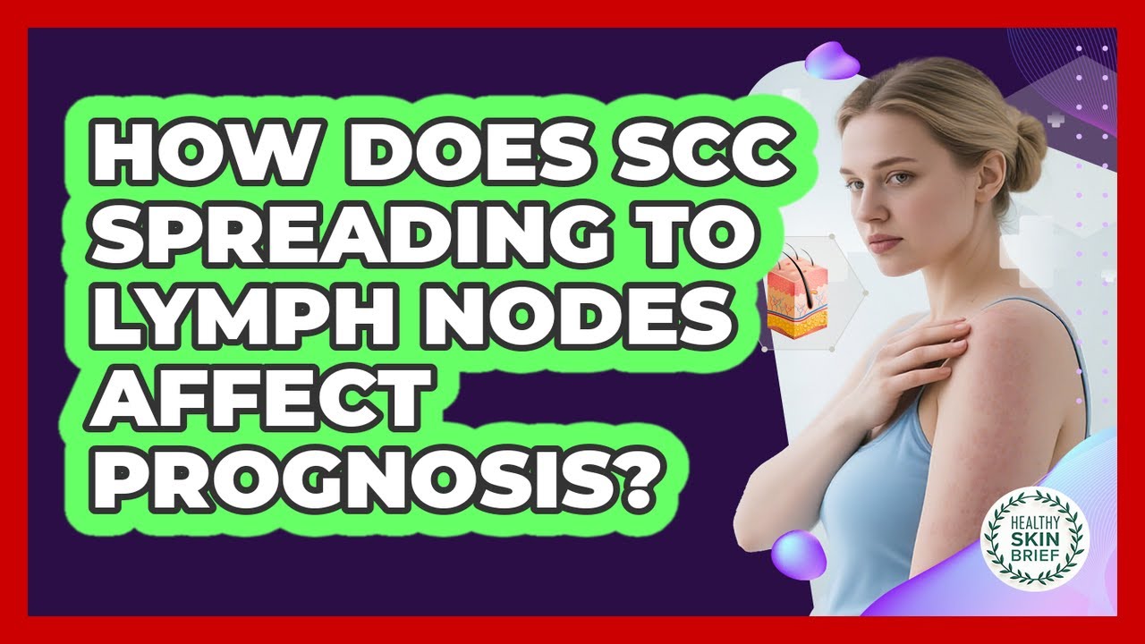 How Does SCC Spreading to Lymph Nodes Affect Prognosis?