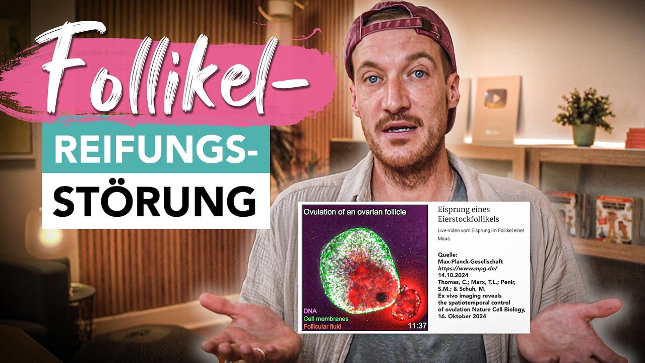 Die häufigste Zyklusstörung? Keine Eisprung? Schlechter Schlaf und Co. Ist es die Follikelreifung?