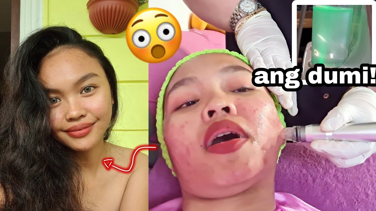 Part 6: I tried HydraFacial by Pretty calm, Ano ba ito?