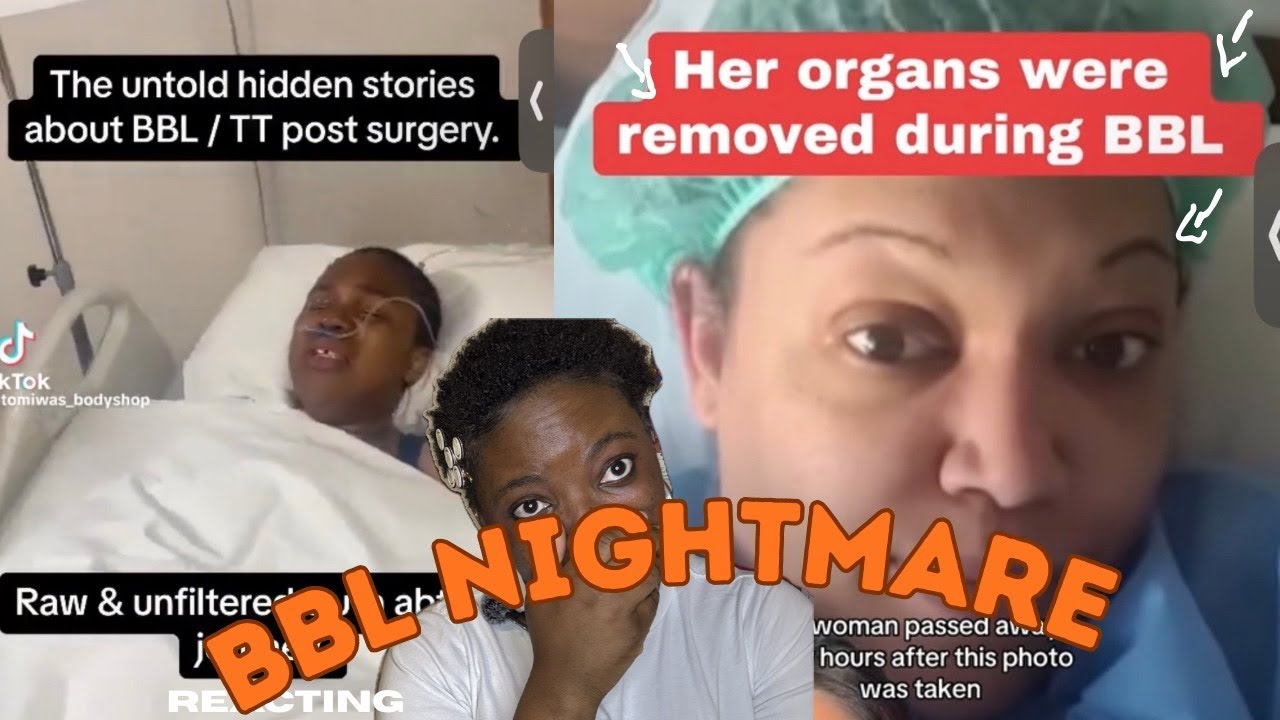 When BBLs Go Wrong…  Plastic Surgery Reaction