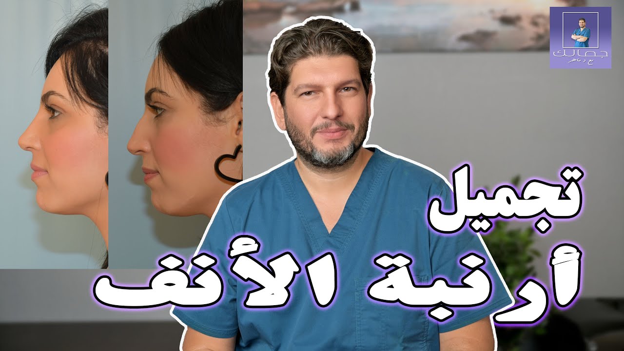 تجميل أرنبة الأنف