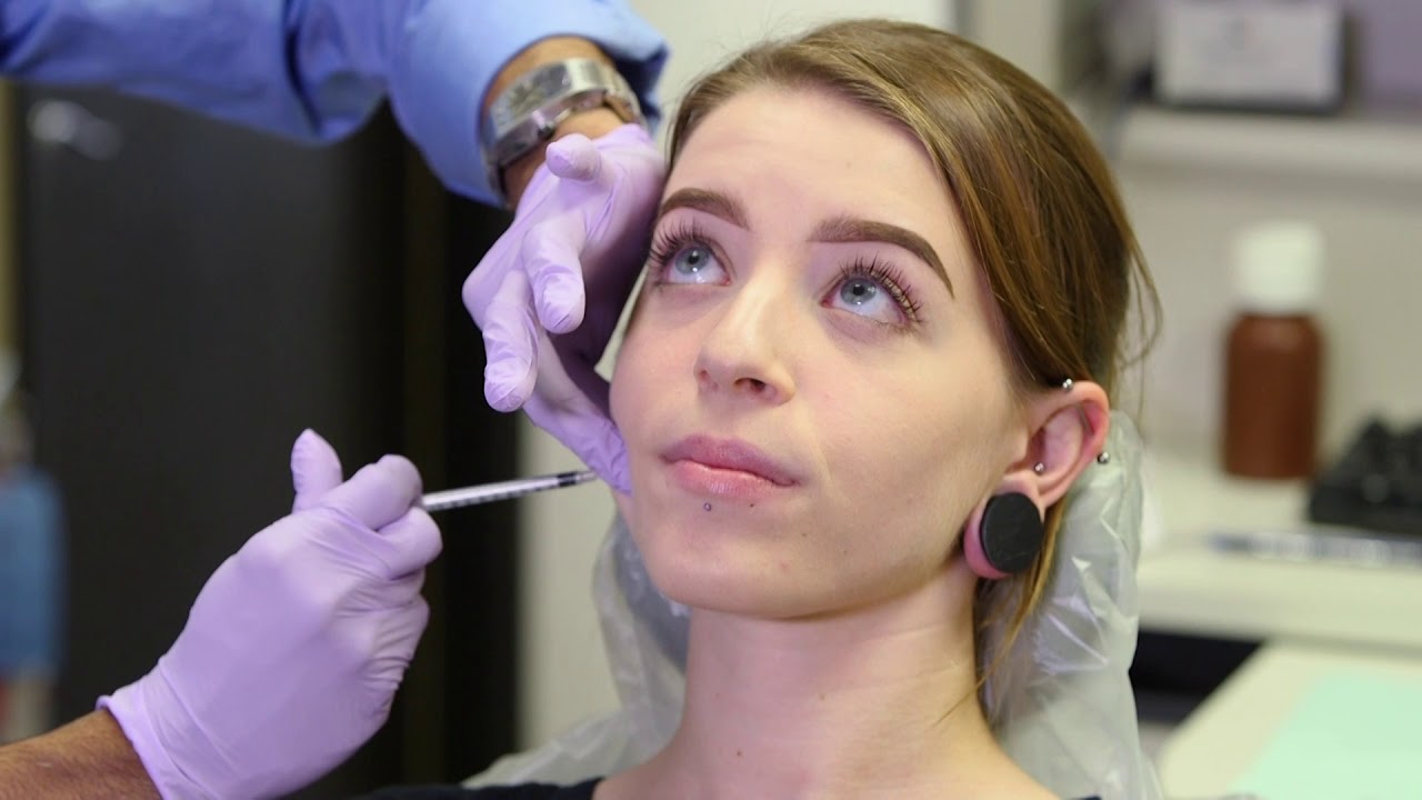 Serenity Dental Live Procedure: TMD Treatment with BOTOX