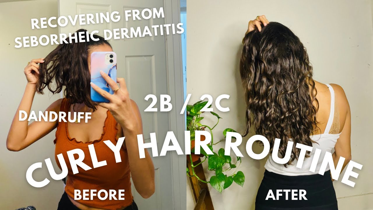 2B/2C CURLY HAIR ROUTINE | recovering from seborrheic dermatitis | tips for treating dandruff