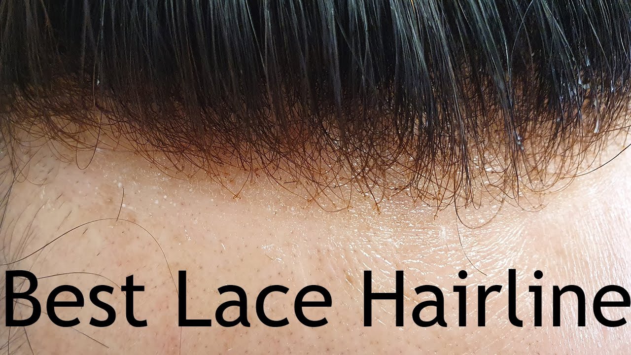 Hair Replacement System Cut And Fitted live, French Lace System, Graduated Hairline, Bleached Knots.