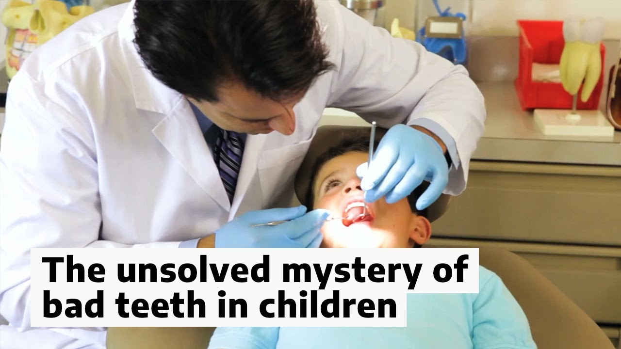 The unsolved mystery of bad teeth in children