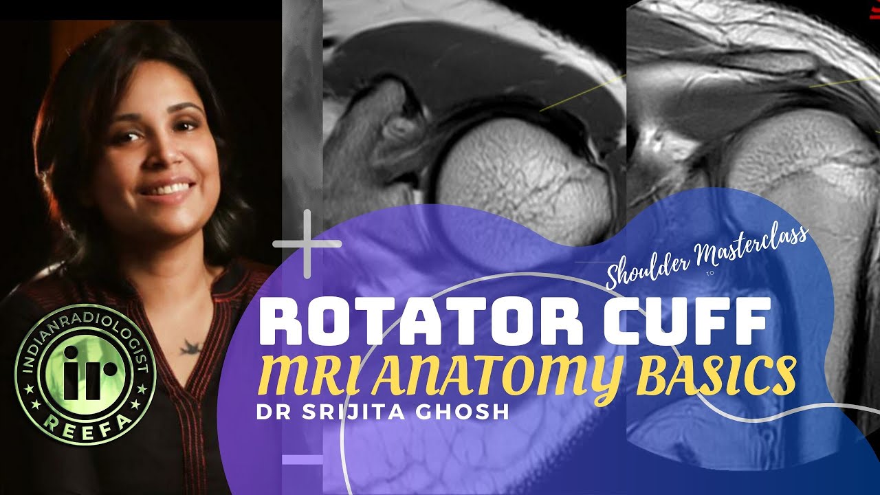 ROTATOR CUFF MRI ANATOMY | SRIJITA GHOSH | Supraspinatus Tendon | Infraspinatus | Footprint