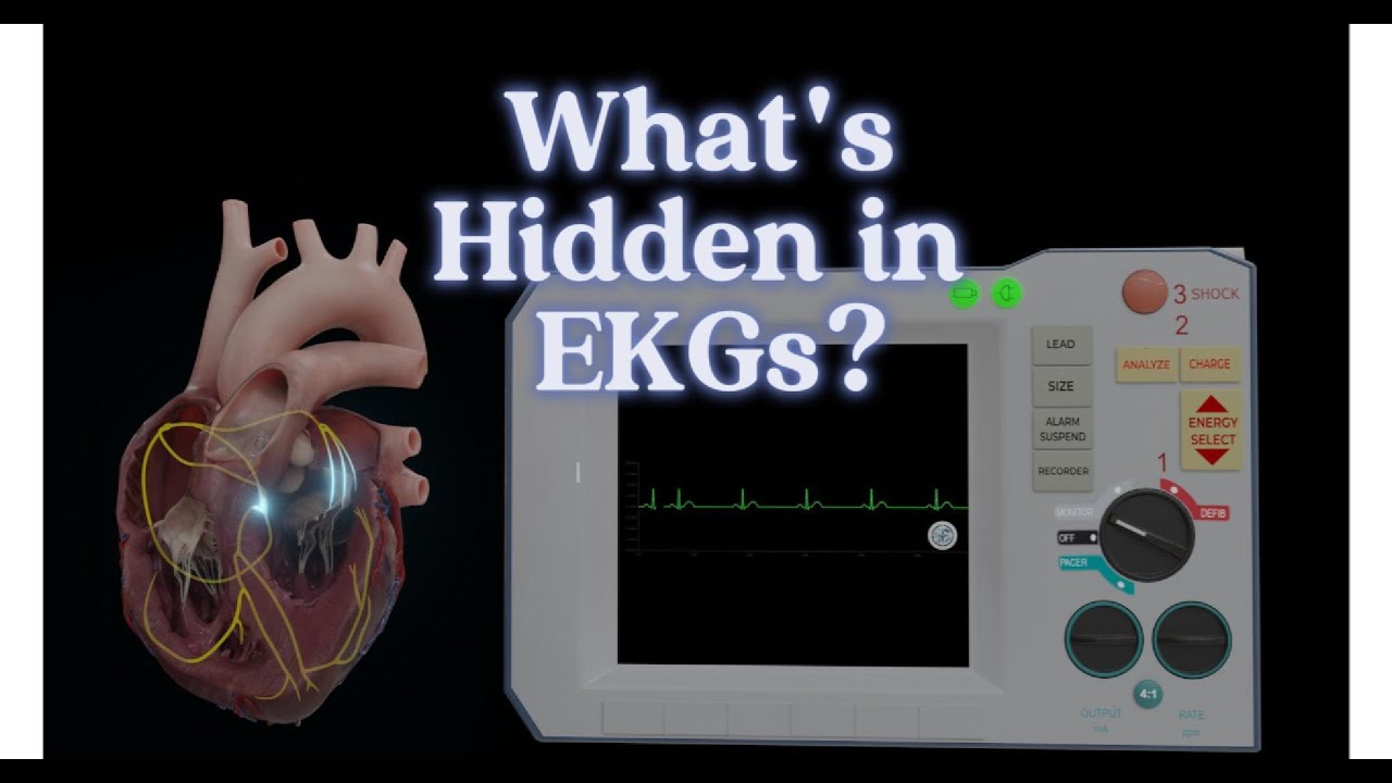 How EKG Waves Show What’s Happening in Your Heart (Animated)